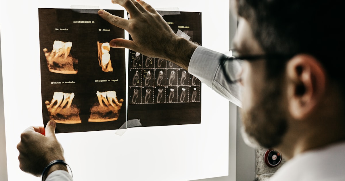 Why Tongue Hygiene Deserves More Chairside Attention (And the Tools Catching Up to the Science)